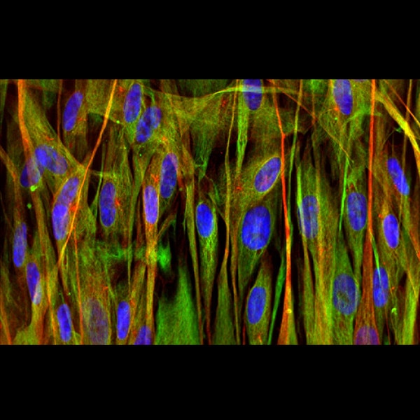 Immunofluorescence image of human dental pulp stem cells labeled with DSHB antibody 3CB2 against Vimentin (green). PMID: 29370163, Fig. 5D.